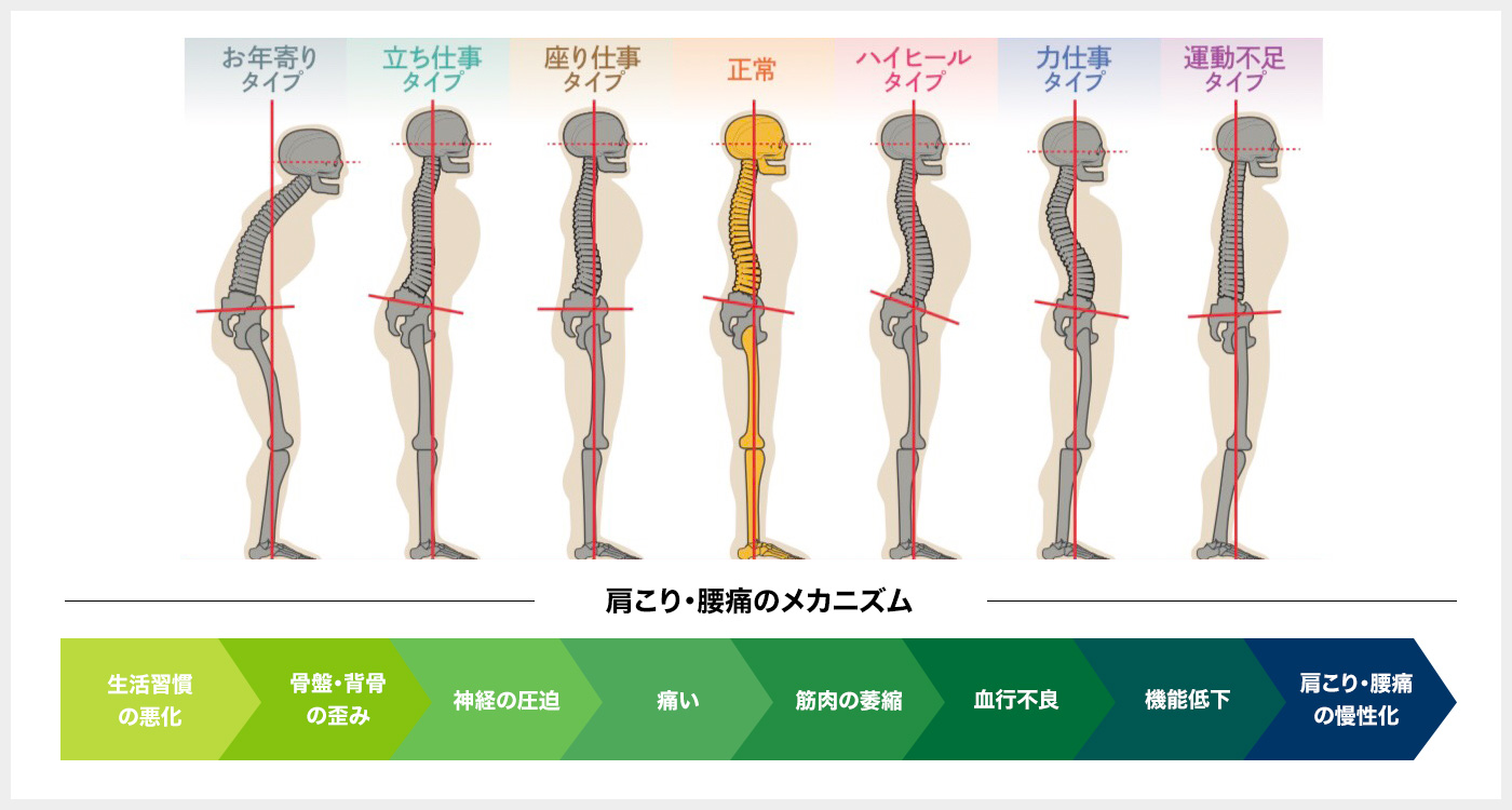 肩こり・腰痛のメカニズム